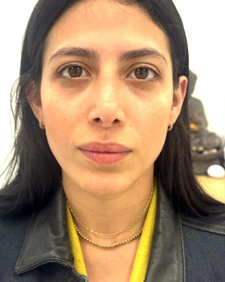 Rostro, antes y después: antes