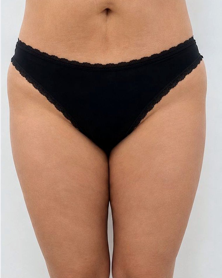 Piernas y abdomen, antes y después: después
